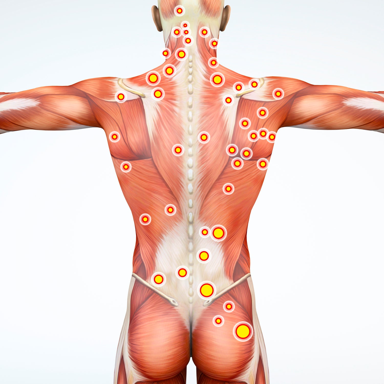 Illustration showing trigger point location on the back of a person